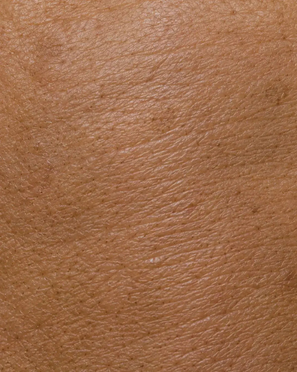 Anti-Aging