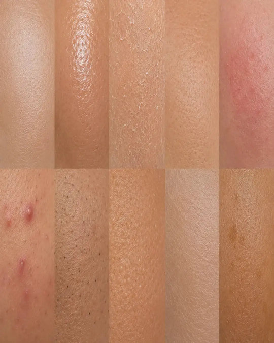 All Skin Types