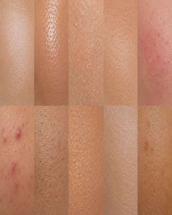 All Skin Types