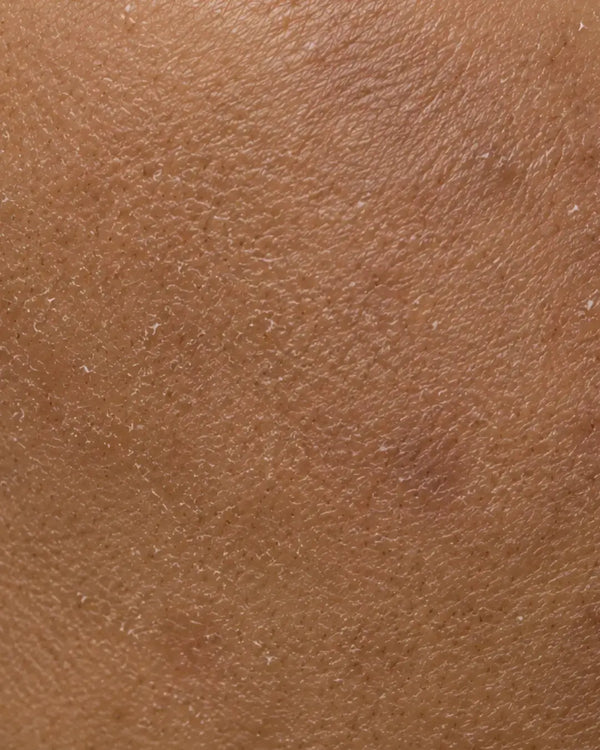 Rought Texture /Tan / Dead Skin